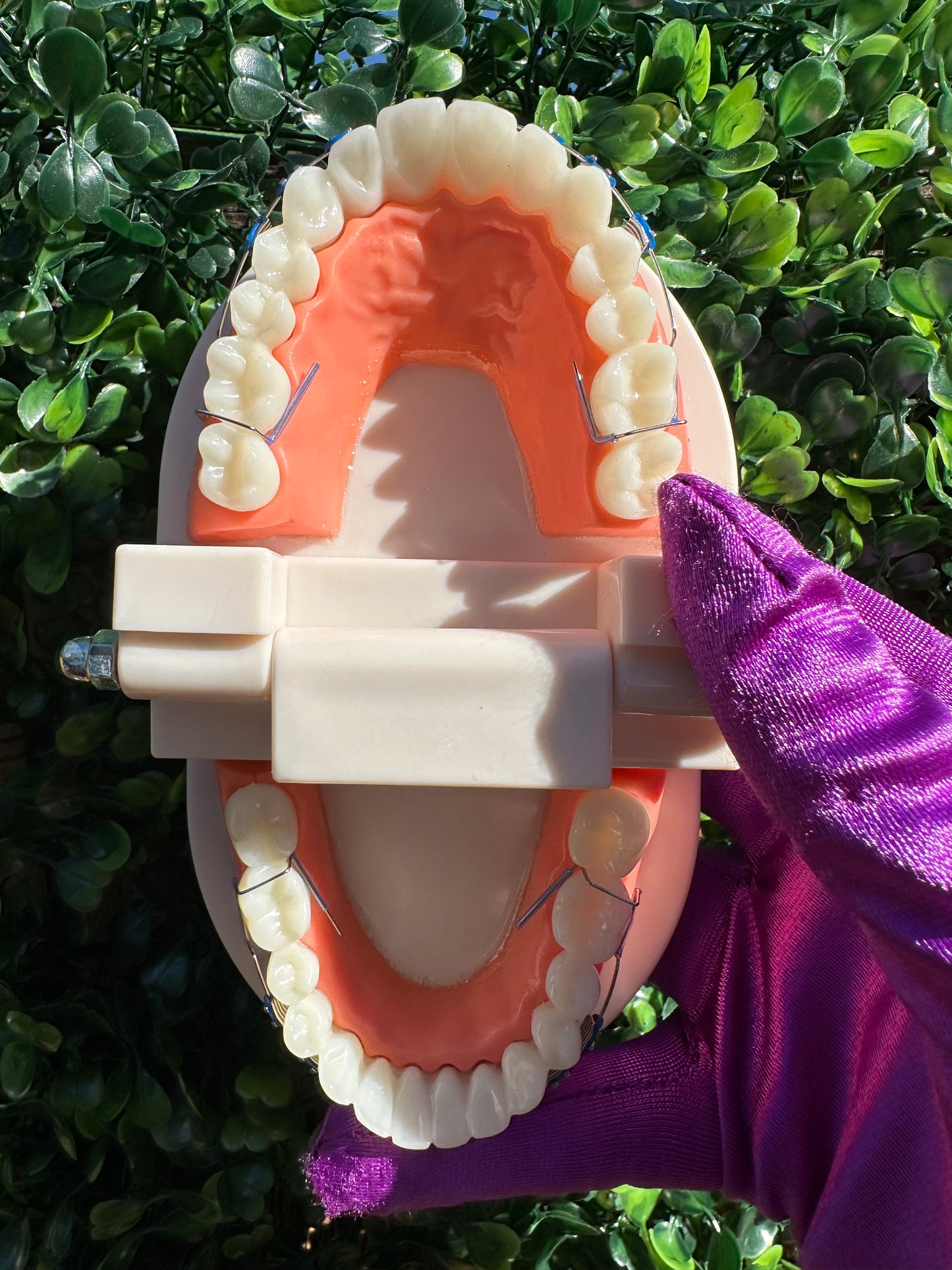Fake Clip-on braces