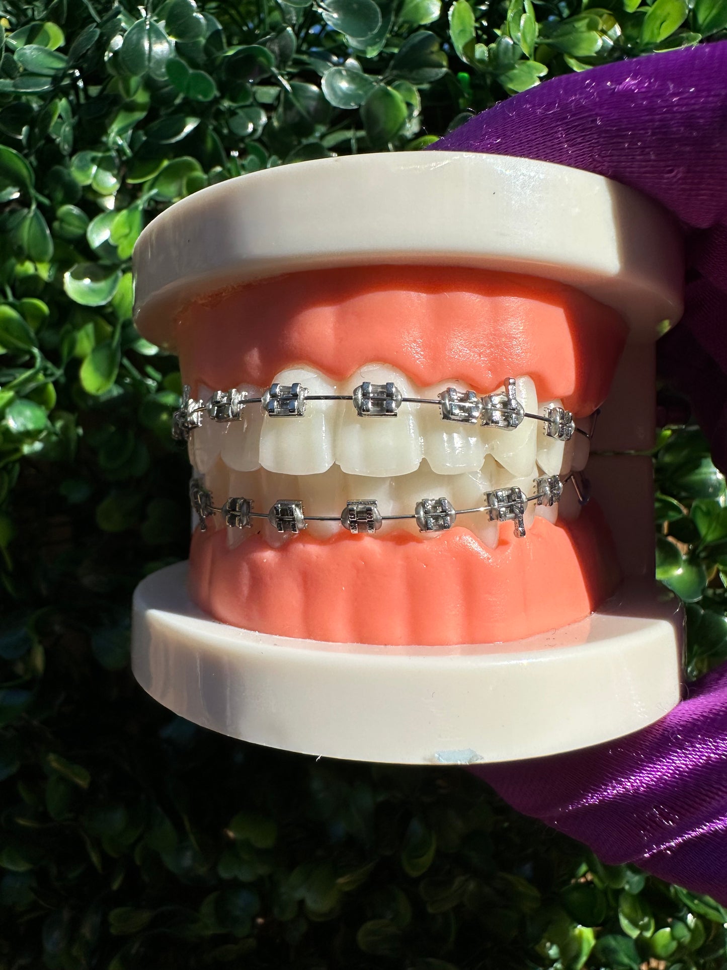 Clip on Braces