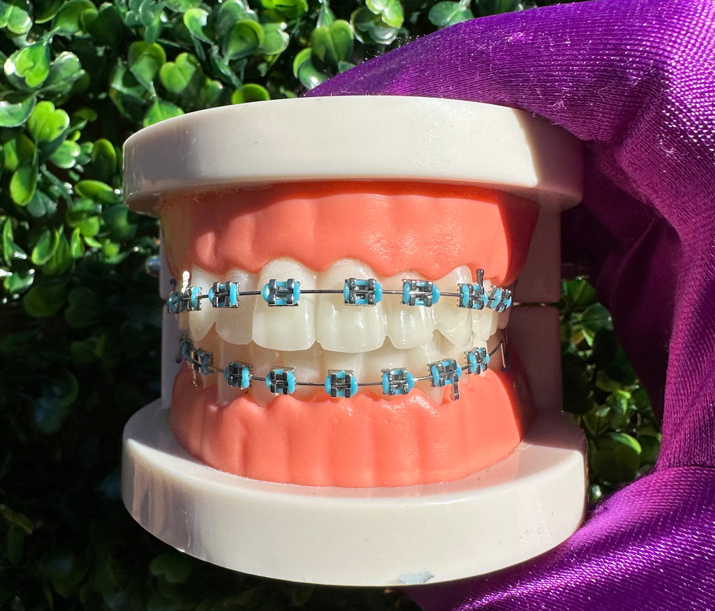 Clip-on braces