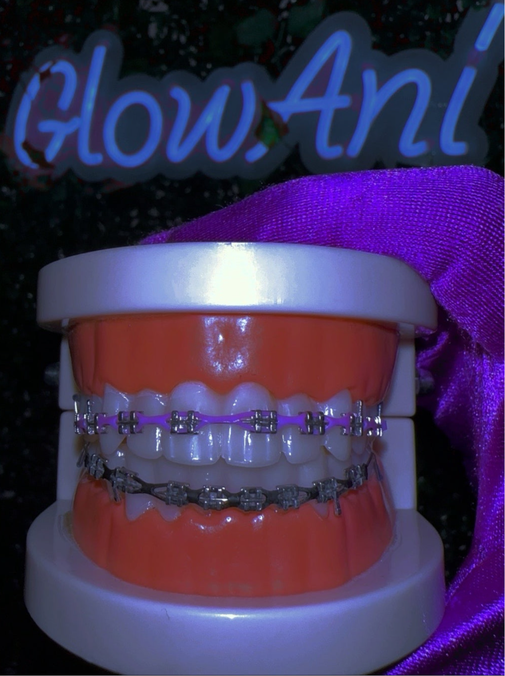 Powerchain Clip on Braces