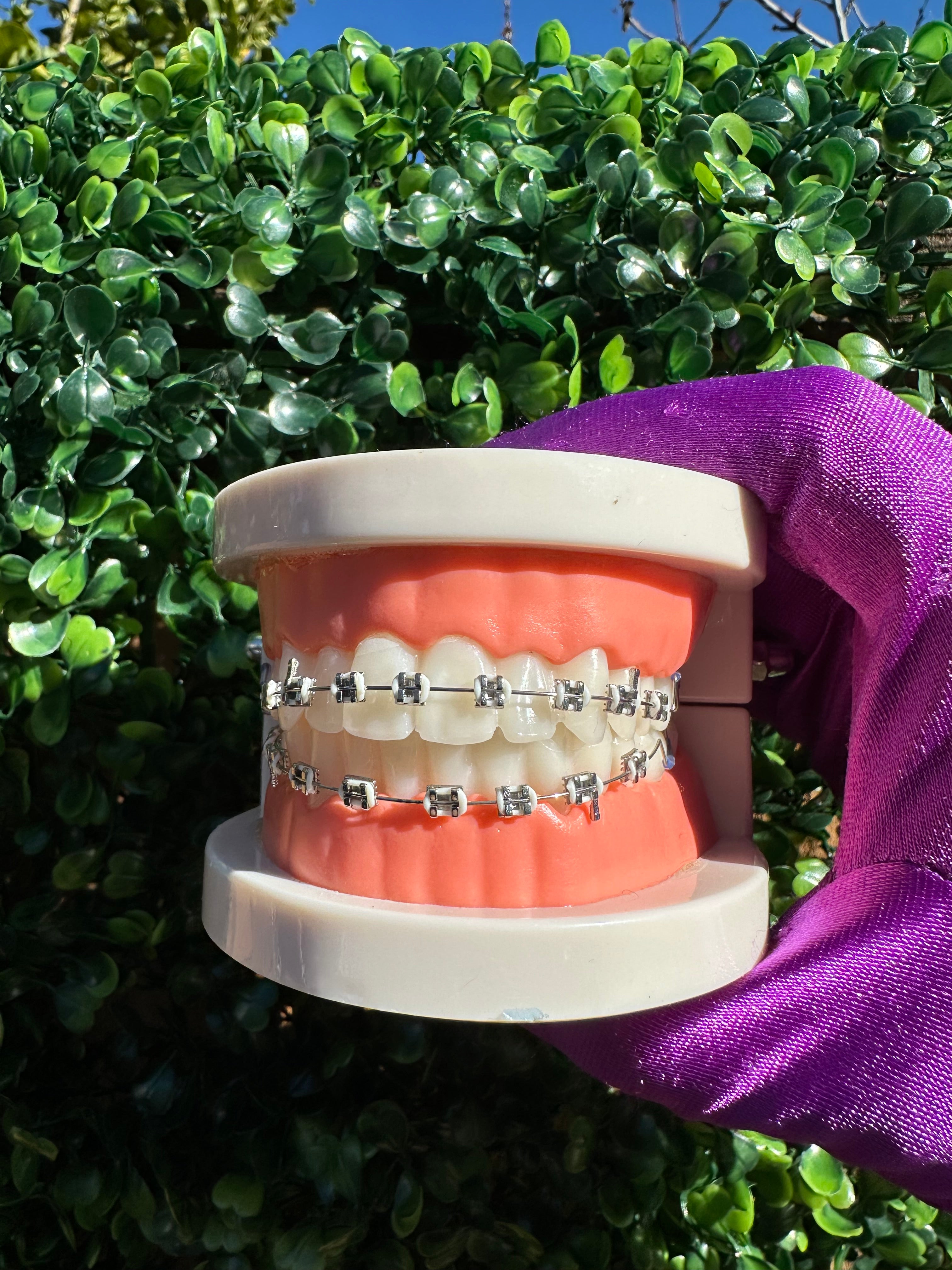 Clip-on braces