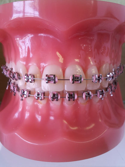 Regular Braces