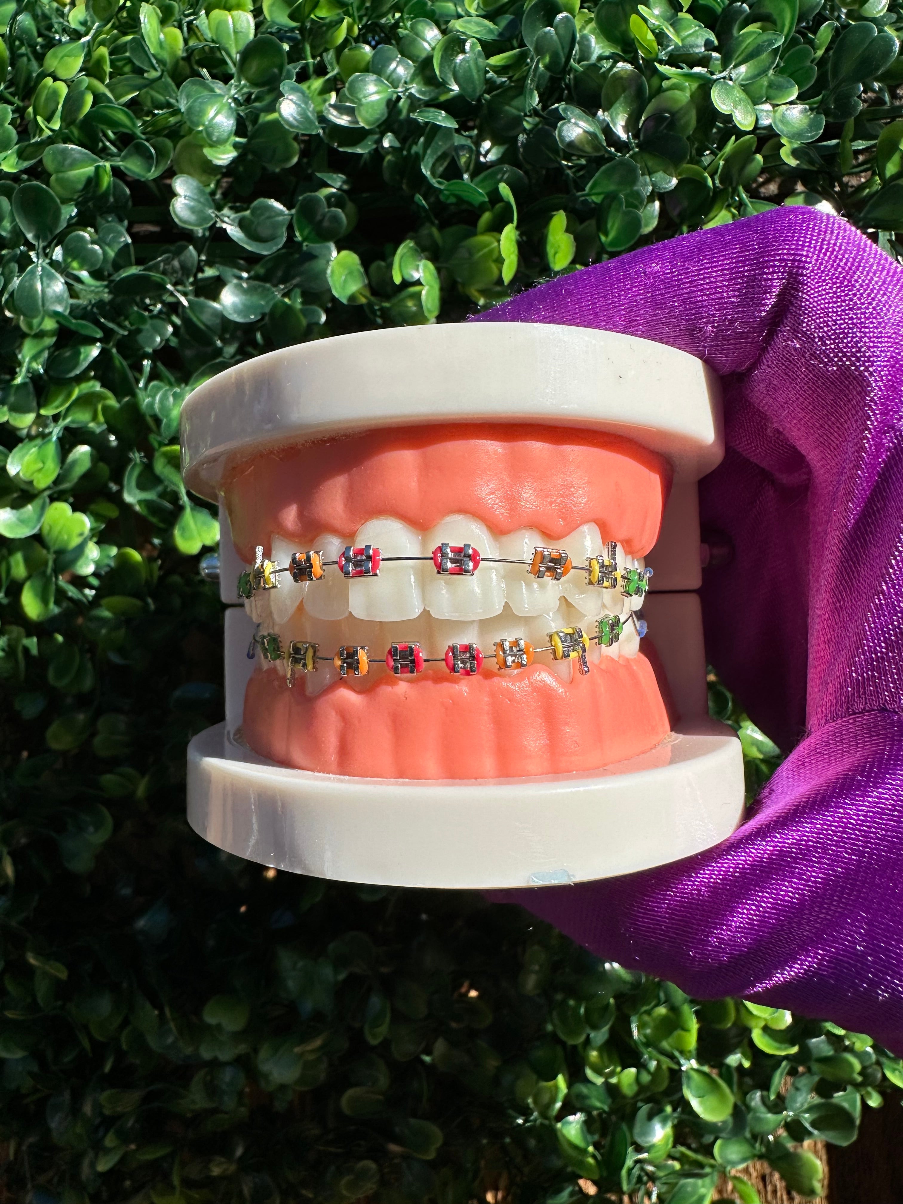 Clip-on braces