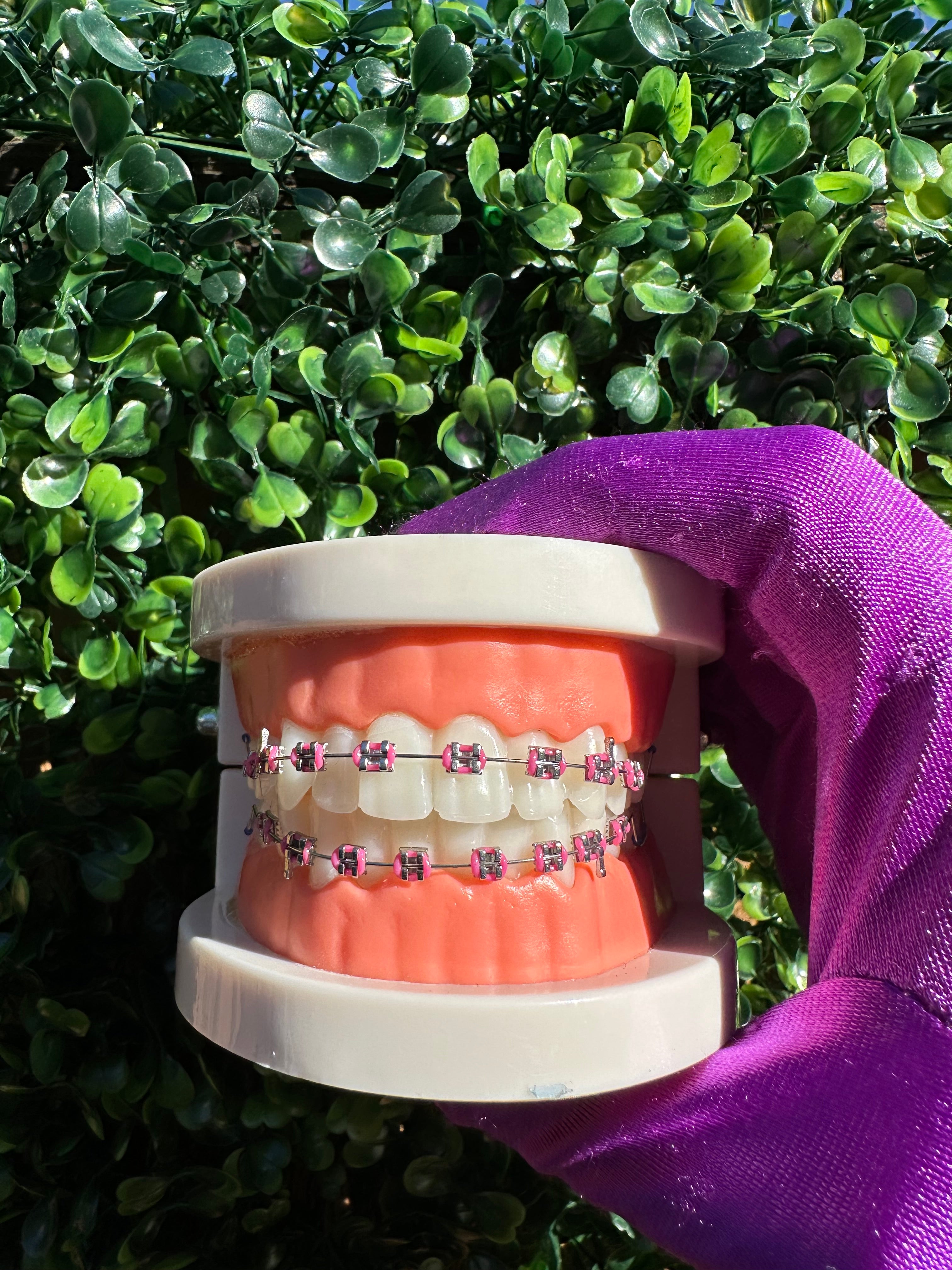 Clip-on braces
