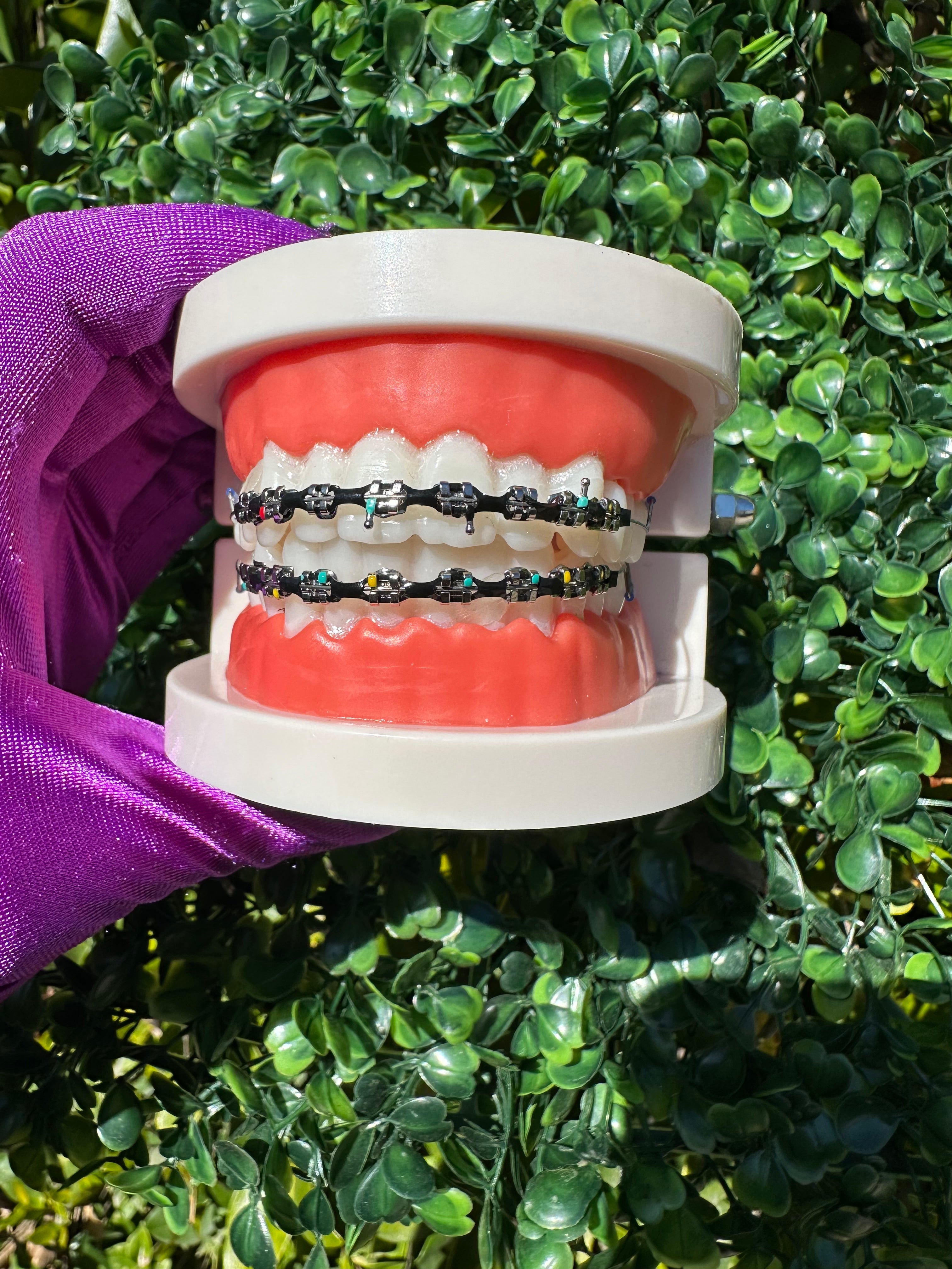 Powerchain clip-on braces