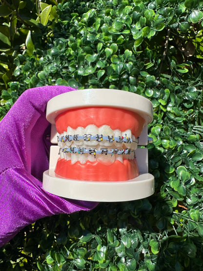 Powerchain clip-ons