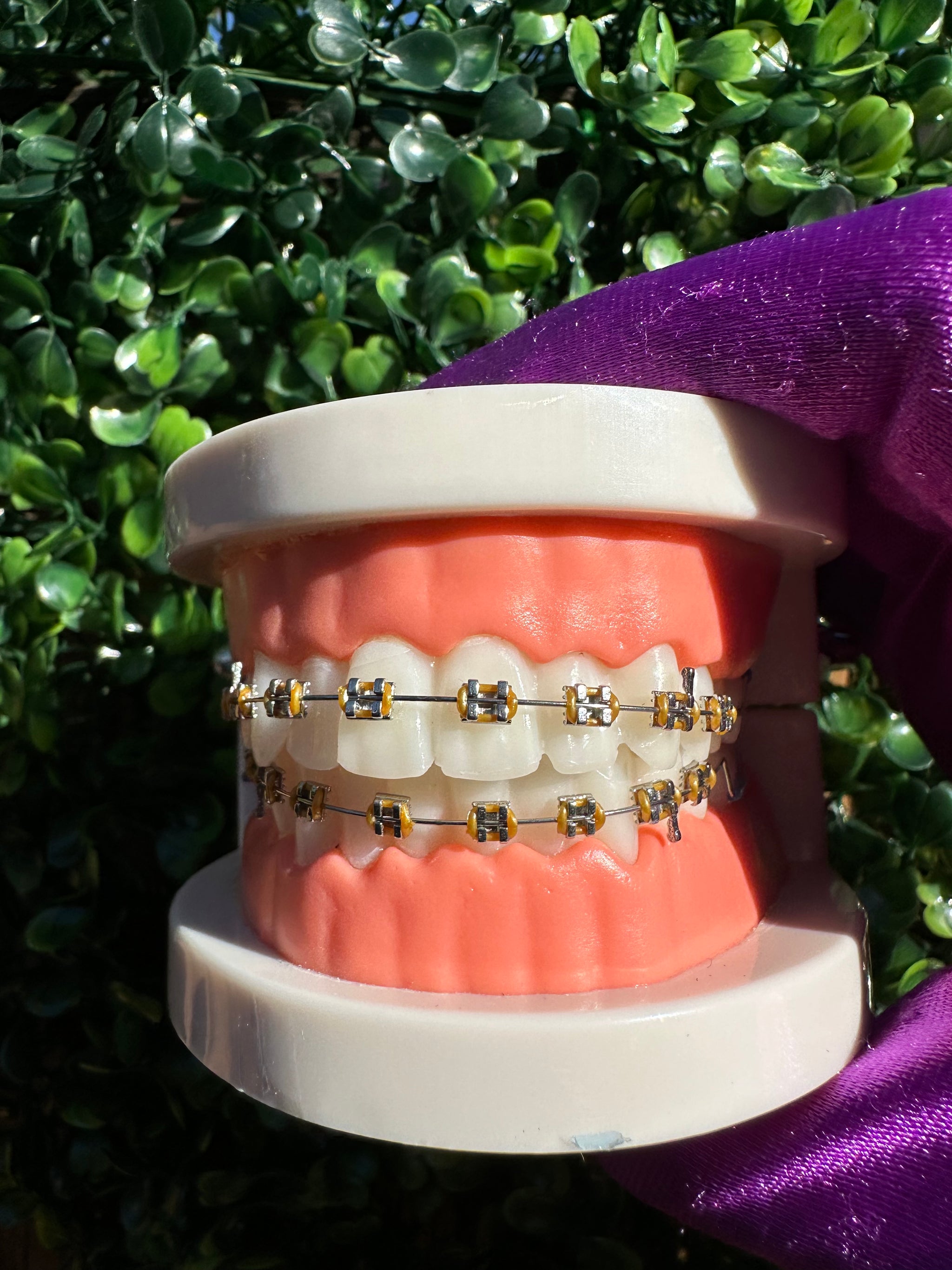 Clip on Braces – GlowAni