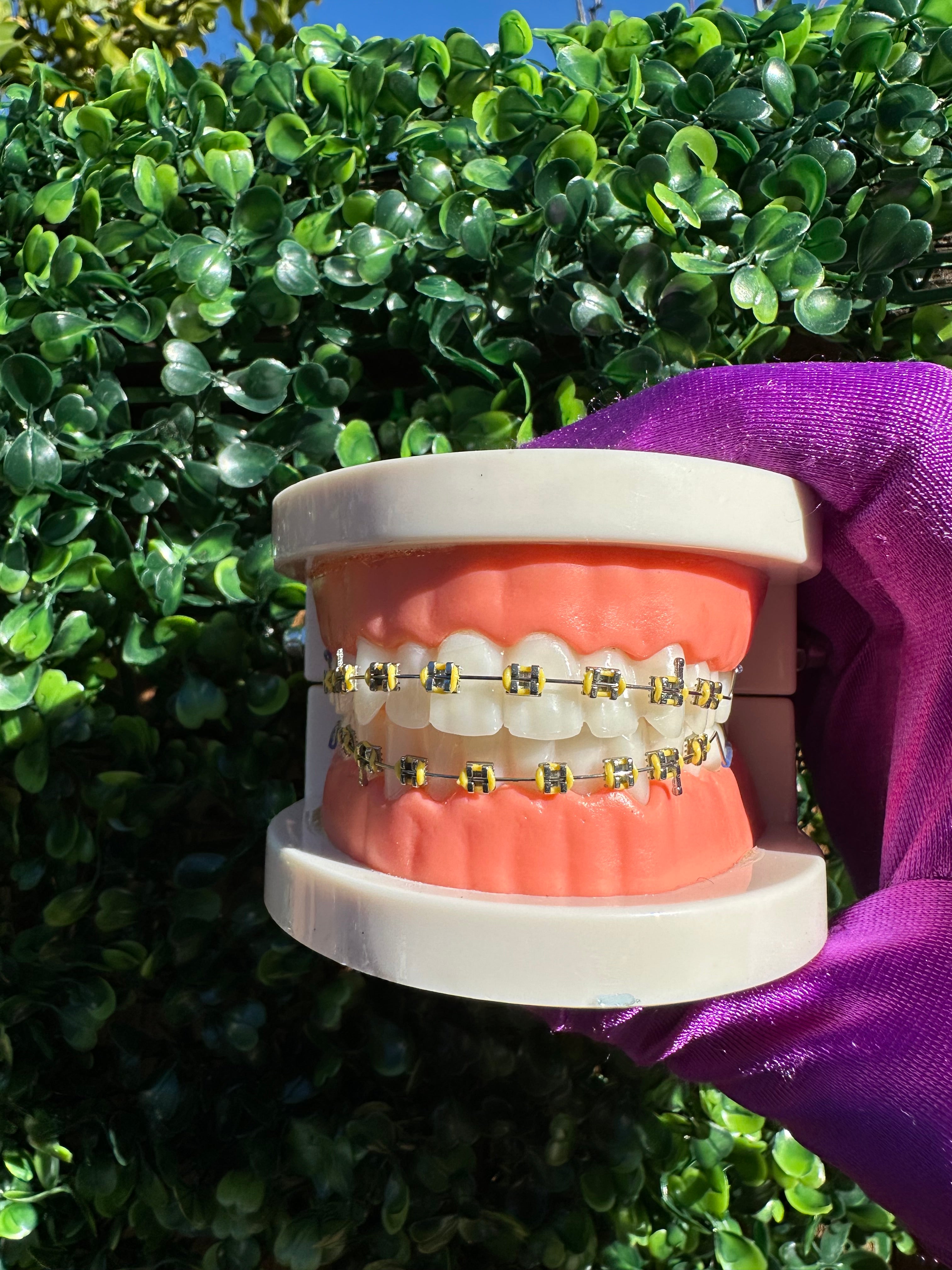 Clip-on braces