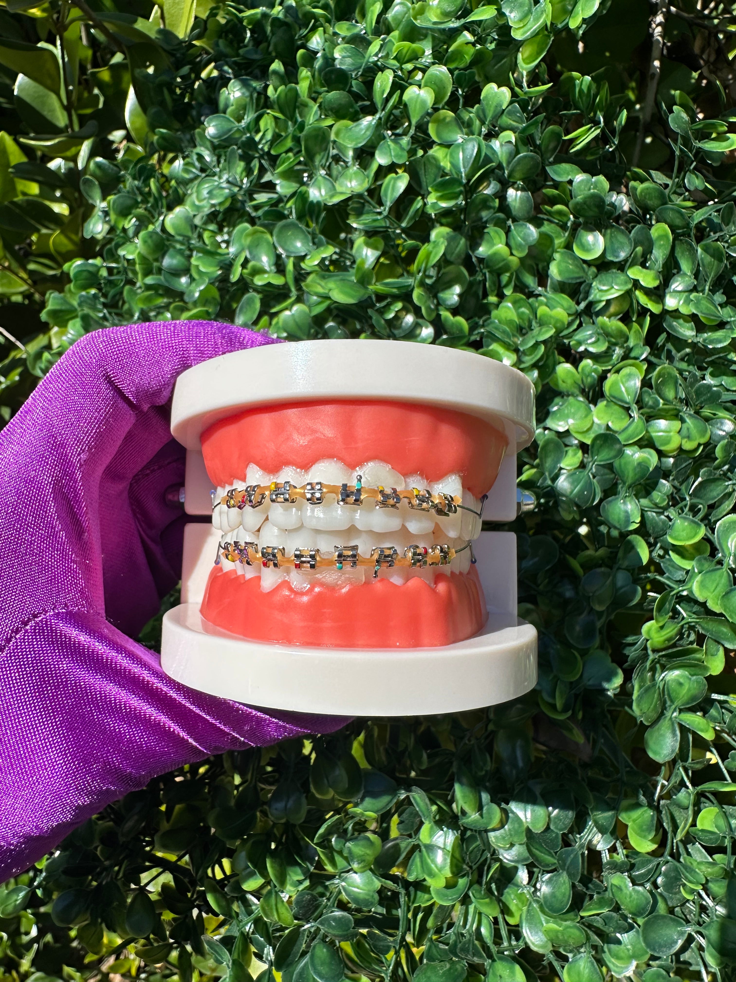 Powerchain clip-on braces