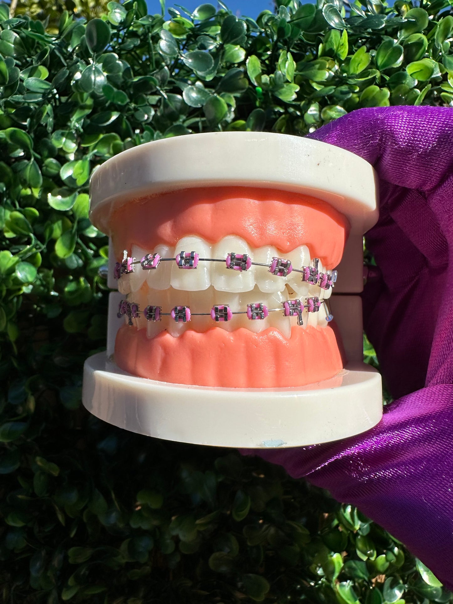 Fake Clip-on braces