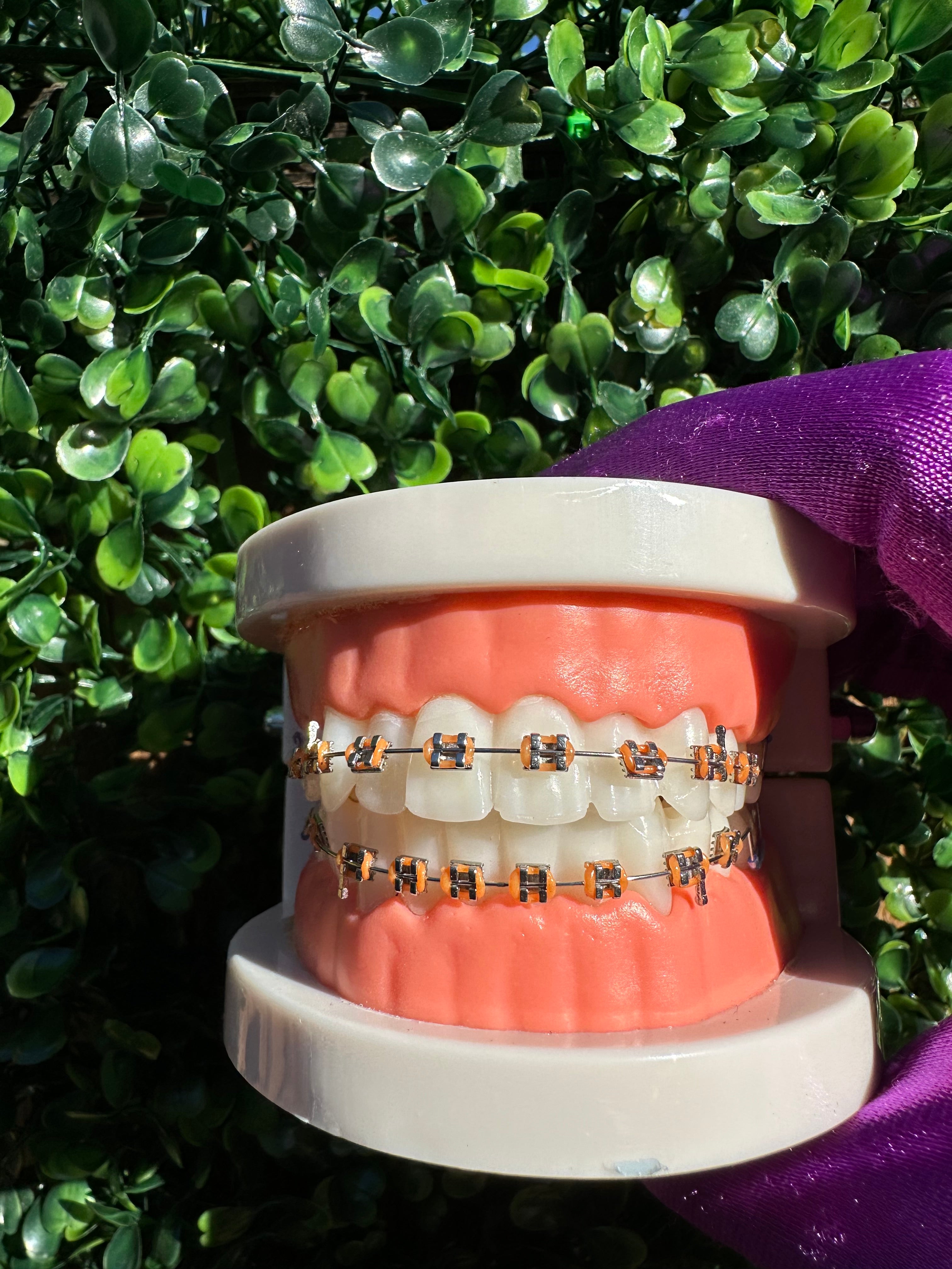 Clip-on braces