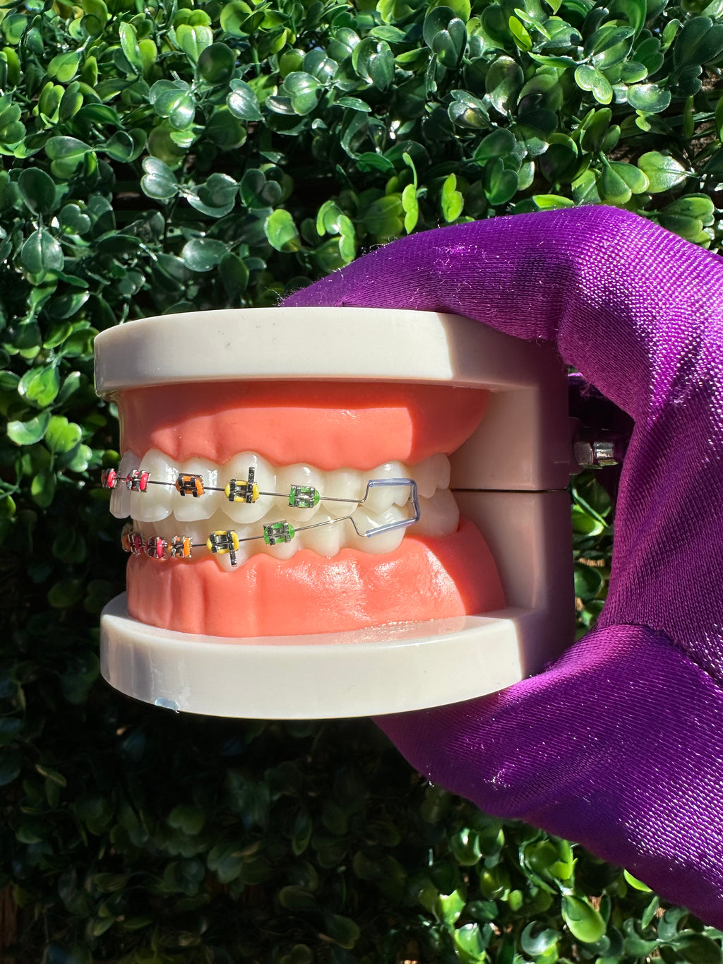 Clip-on braces
