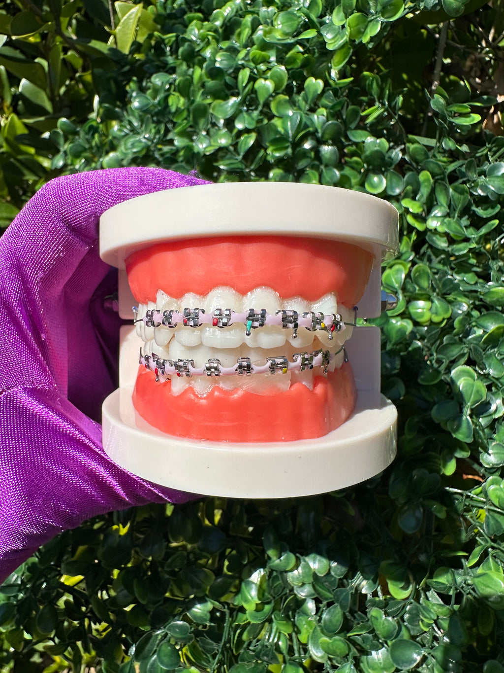 Powerchain clip-on braces