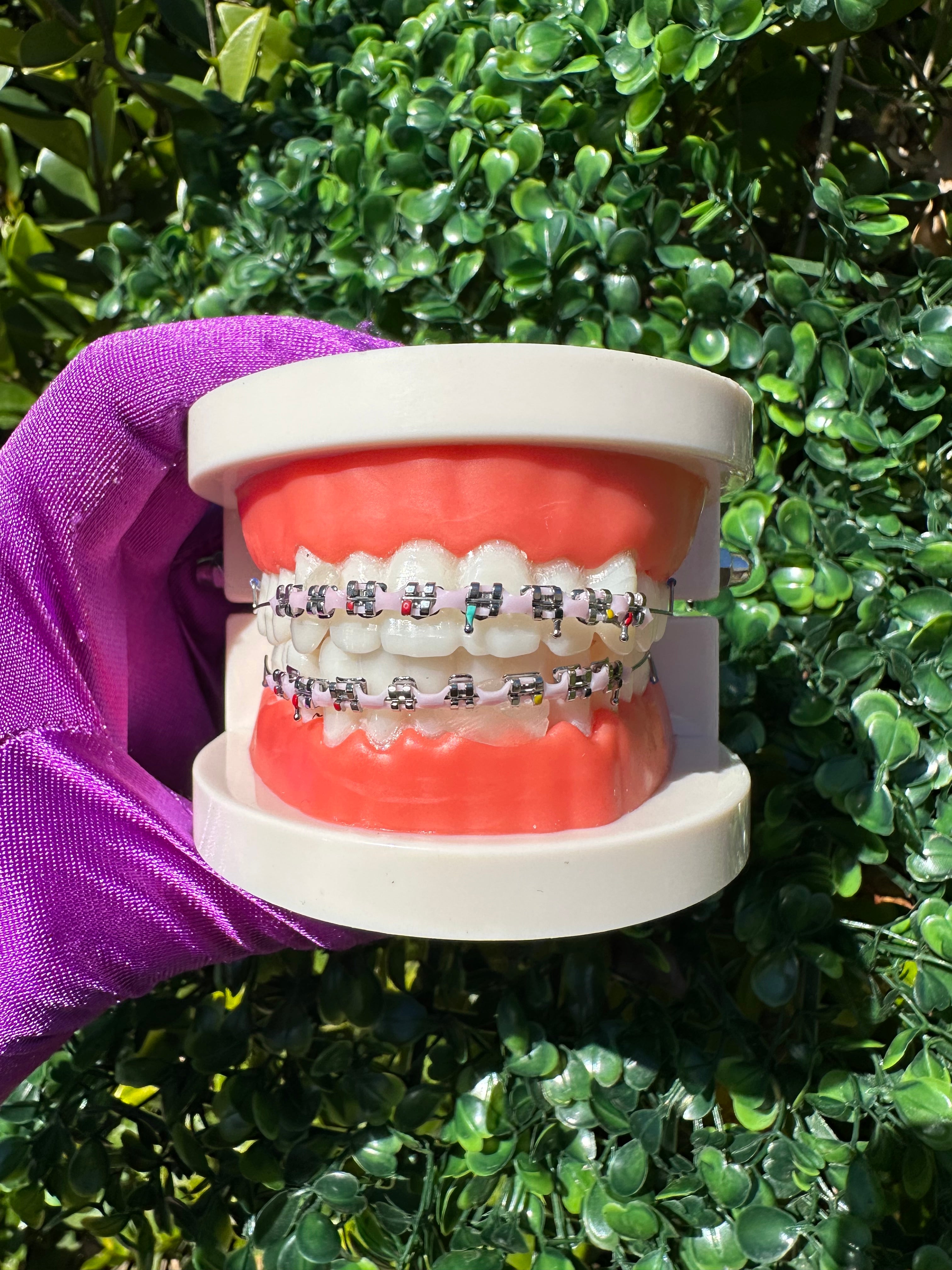 Powerchain clip-on braces