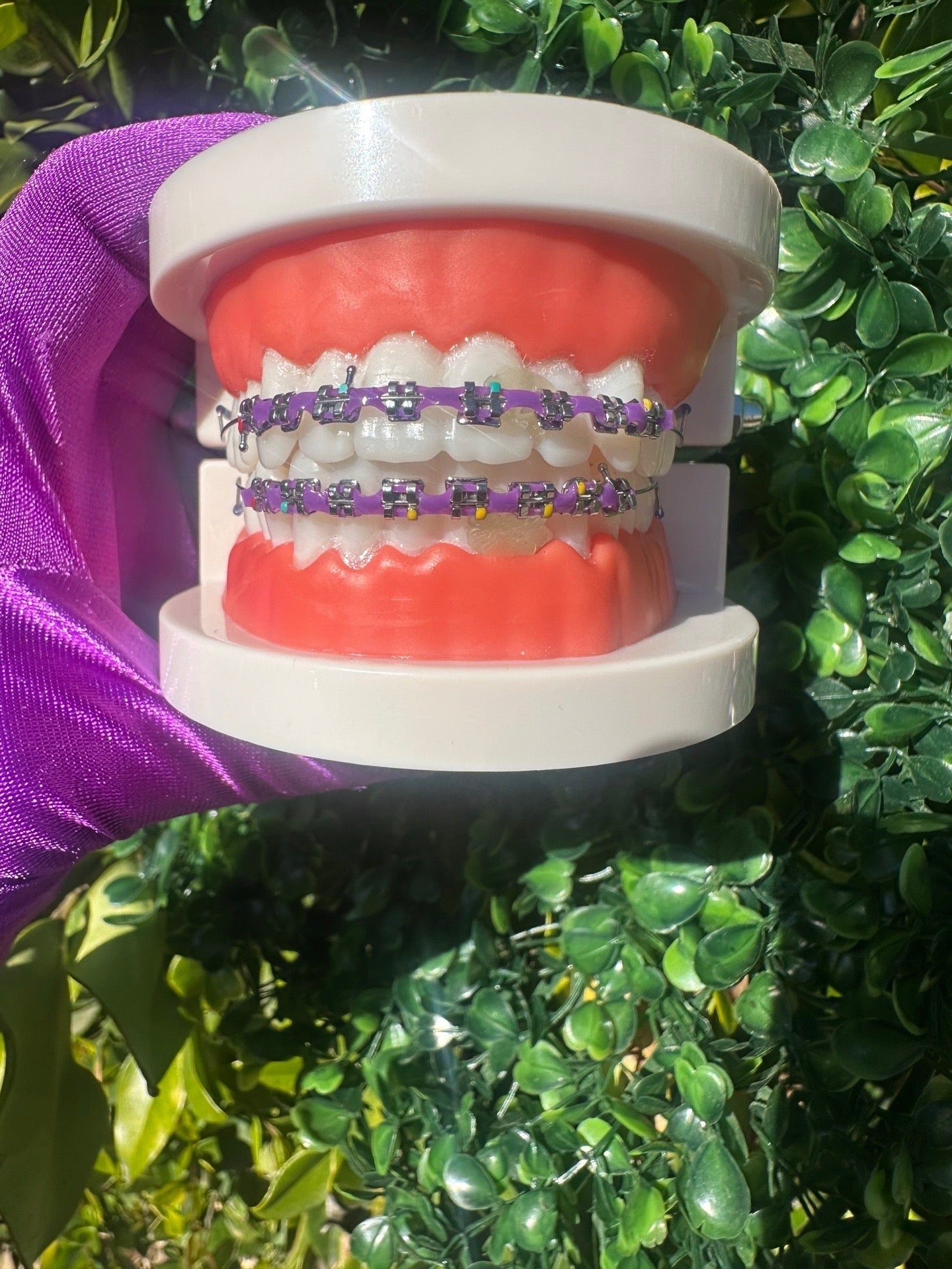 Powerchain clip-on braces