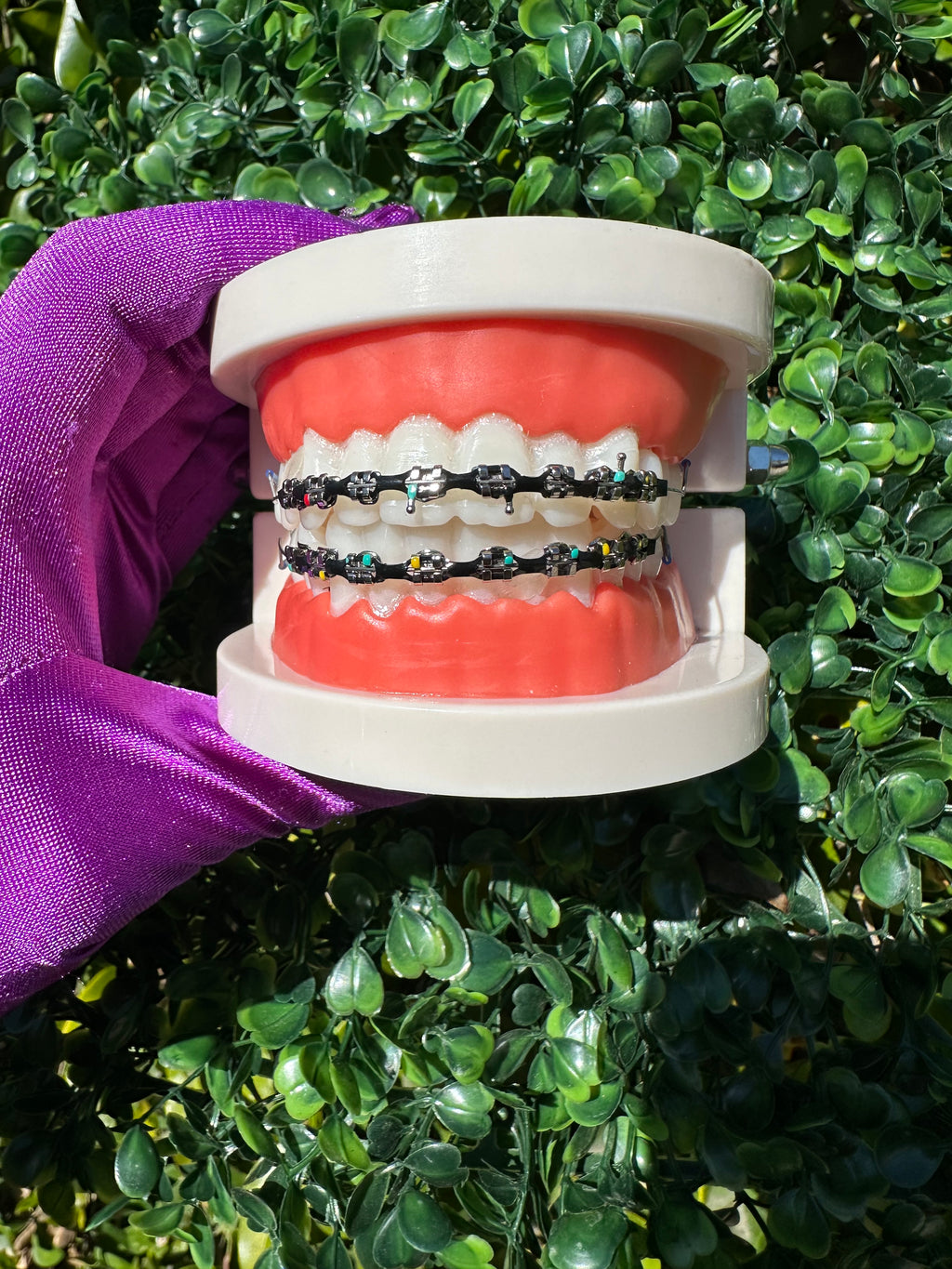 Powerchain clip-on braces