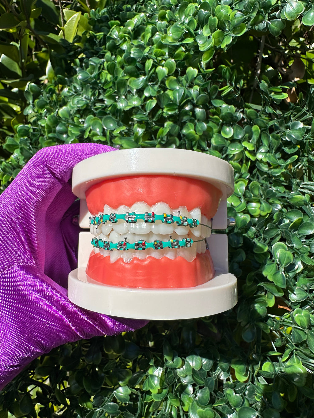 Powerchain clip-on braces