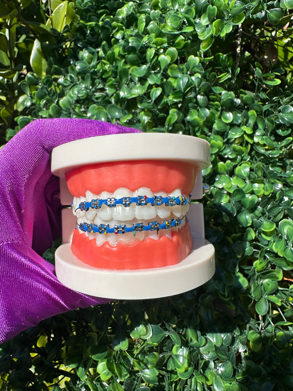 Powerchain clip-on braces