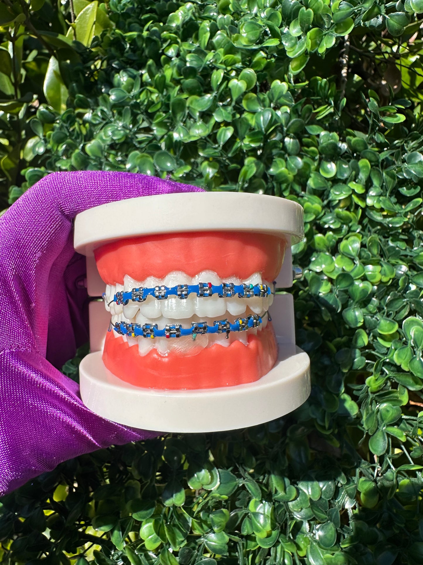 Powerchain clip-on braces