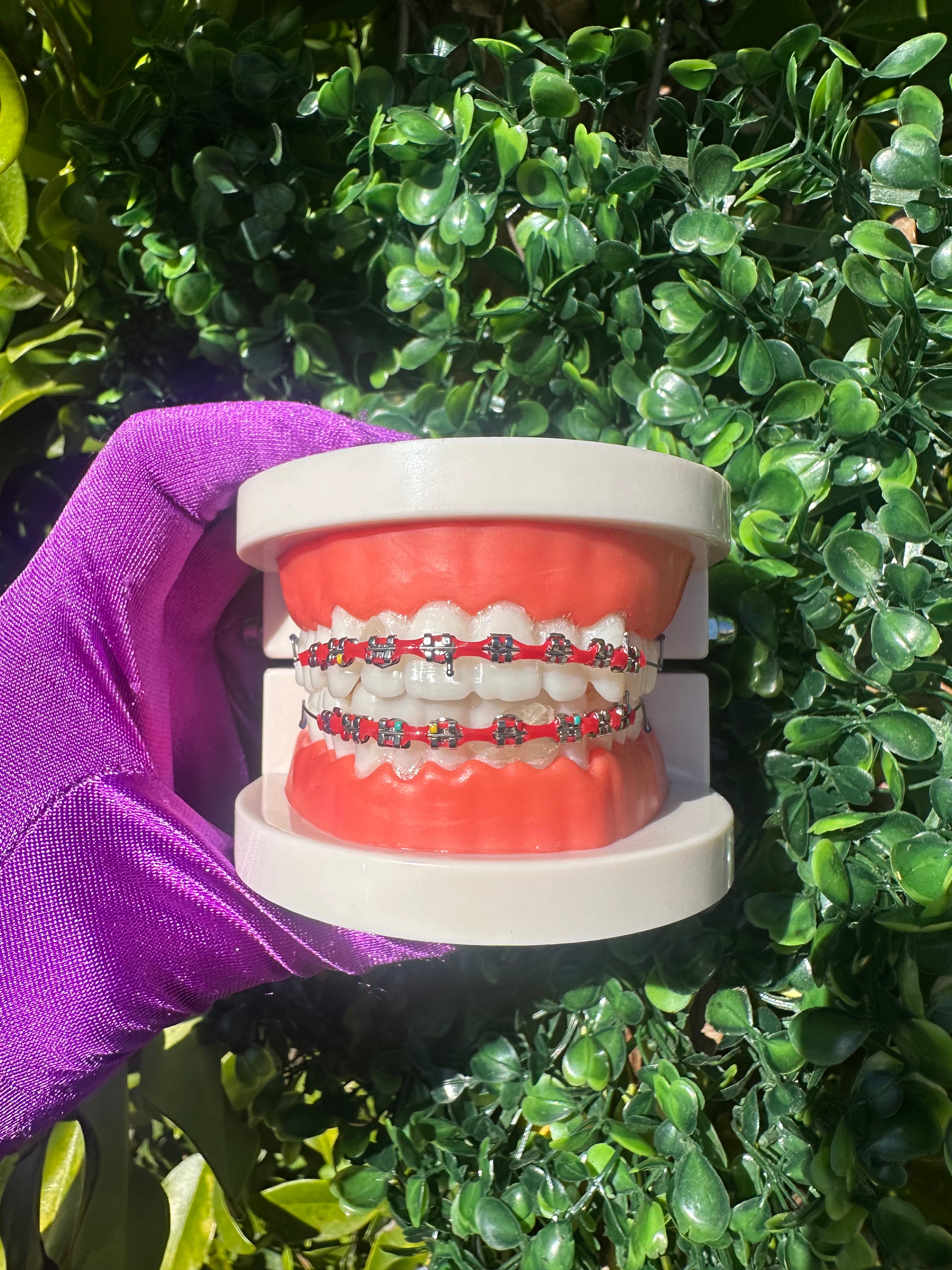 Powerchain clip-on braces